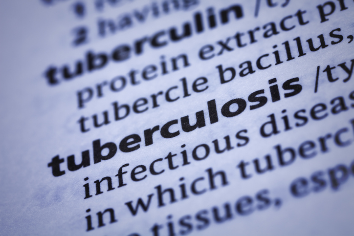 Tuberculosis